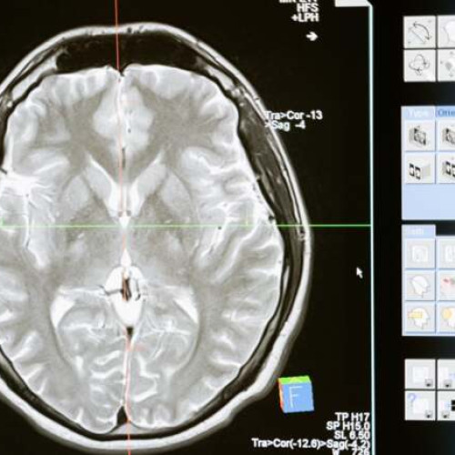 Spitalul CFR Timișoara își extinde programul de lucru pentru examinările CT