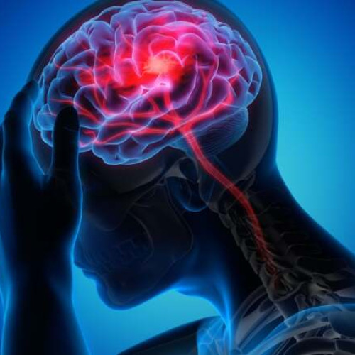 Accidentul vascular cerebral: prevenire și conștientizare