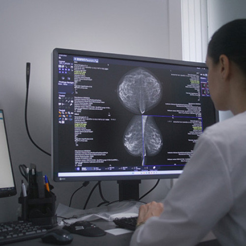 MedLife lansează un proiect inovator de utilizare a inteligenței artificiale în radiologie, deschizând drumul către o nouă eră în medicina românească, potrivit digi24.ro.
