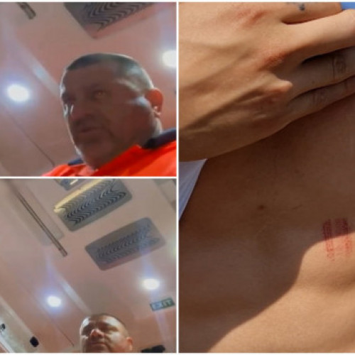 Incident violent la Olt: doi adolescenți susțin că au fost bătuți de angajați ai poliției și ambulanței