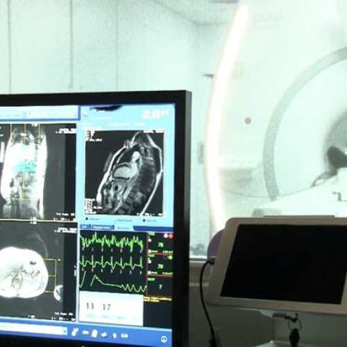 RMN-ul cardiac de stres, o metodă modernă de diagnostic în cardiologie