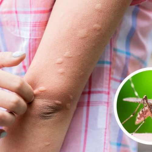 Cluj-Napoca: Lupta împotriva țânțarilor continuă! Clujenii cer intervenții în forță a autorităților locale: „Nu putem sta în grădină. Sunt peste tot”