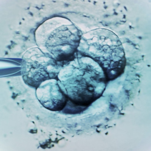 Ceasul biologic al bărbaților, legat de avorturile spontane în cazul fertilizării in vitro