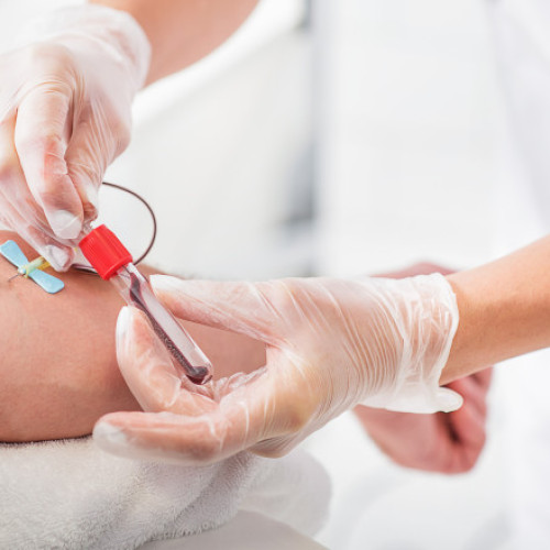 Miniştri ai Mediului din 18 ţări ale UE, supuși unui test de sânge pentru depistarea „poluanților eterni”