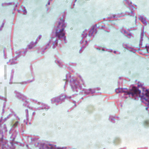 Două cazuri de antrax confirmate în România