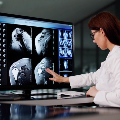 Un proiect uriaș de imagistică medicală va schimba felul în care bolile sunt depistate. Ce arată imaginile despre consumul de alcool