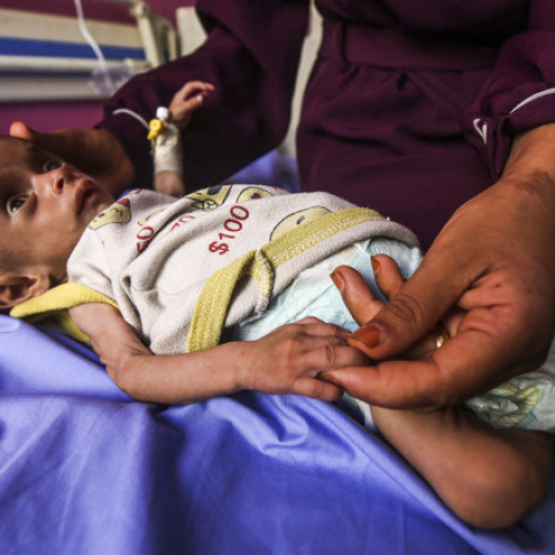 Galerie Foto „Înfometare în masă”. Numărul copiilor subnutriți din Gaza, cu vârste sub 5 ani, s-a triplat în ultimele două săptămâni