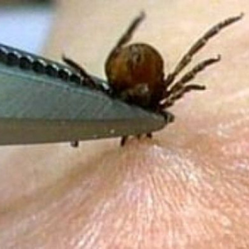 cum să eviți și să tratezi mușcăturile de insecte în sezonul cald