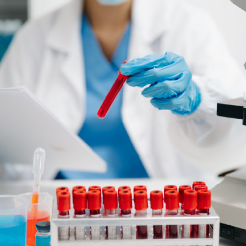 Test nou de sânge poate detecta precoce cancerul ovarian