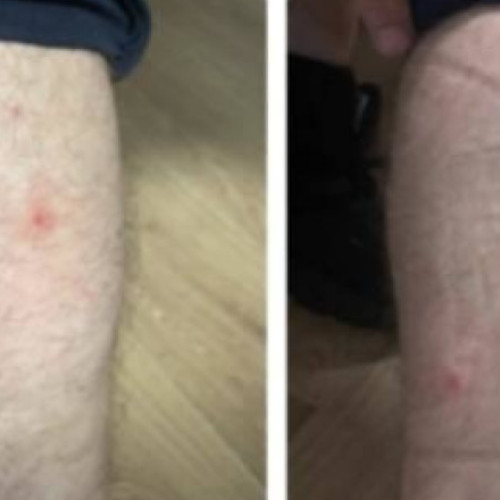 Sindicatul Europol reclamă condiții greu de tolerat în centrele de reținere din București din cauza ploşniţelor