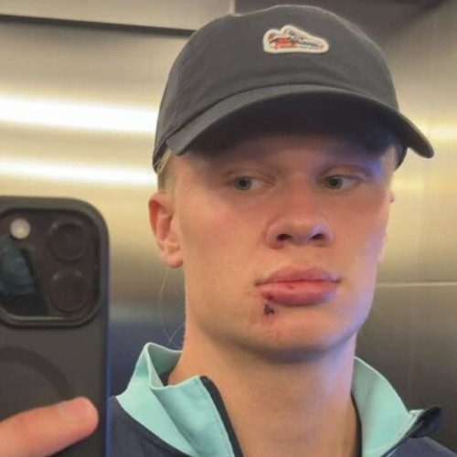 Haaland se tratează după un incident la autocarul naționalei Norvegiei