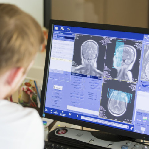 Gemeni britanici diagnosticați cu aceeași boală rară la opt ani distanță