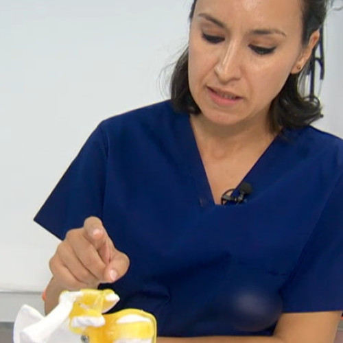 Tendinita calcifiantă, cauză frecventă a durerilor de umăr, afectează mai ales femeile