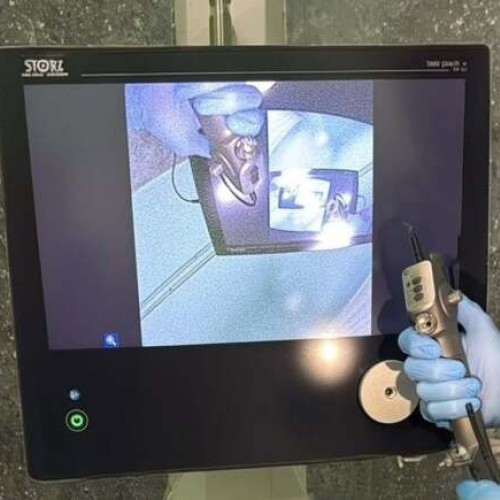 Bronhoscopia, o procedură cheie pentru diagnostic și tratament la spitalul CFR Timișoara