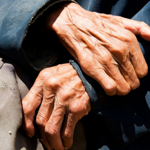 Analiză profundă arată longevitatea fără declin cerebral sever la o supercentenară