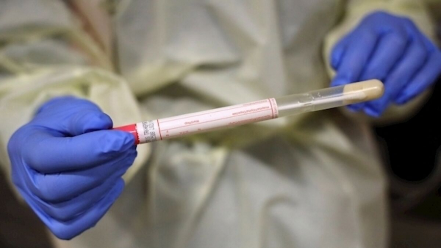 Varianta Stratus a COVID-19 provoacă în principal forme ușoare de boală