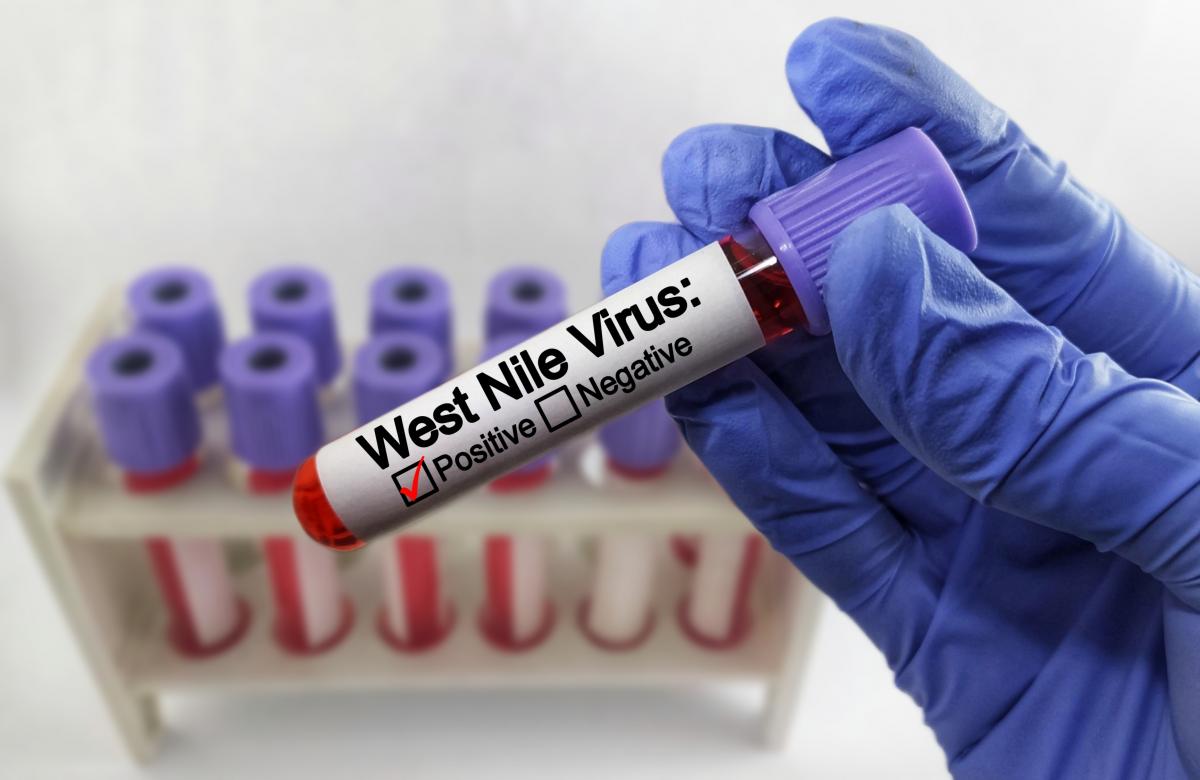 Deces în Brăila din cauza meningitei provocate de virusul West Nile