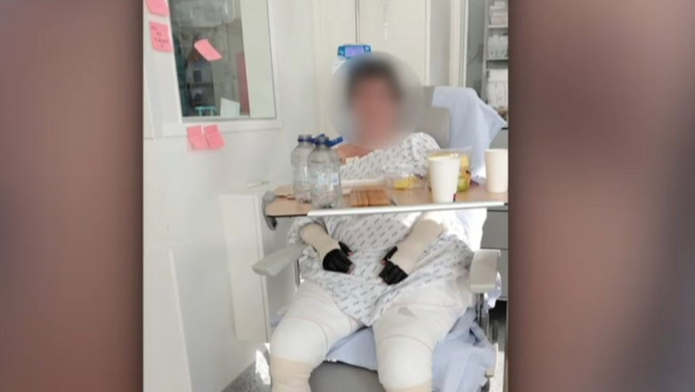 Lavinia, pacienta cu arsuri grave, urmează să fie externată după tratamentul din Belgia