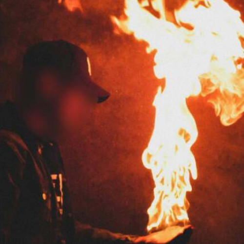 Bărbat din Timișoara s-a autoincendiat în curtea unei clinici medicale