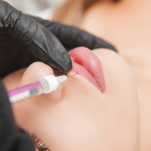 Două femei reținute pentru fraudă după tratamente estetice neplătite în Sectorul 6