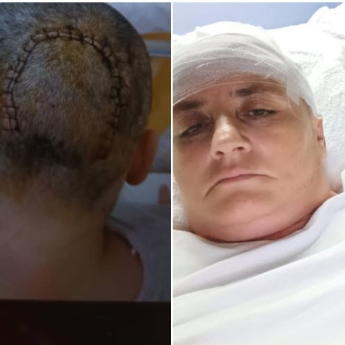 O femeie din Botoșani are nevoie urgentă de sprijin pentru a învinge o tumoră cerebrală