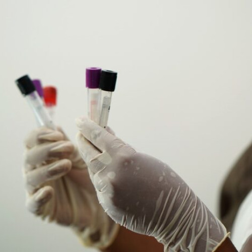 Peste jumătate dintre români nu își fac anual analizele uzuale deși sunt decontate