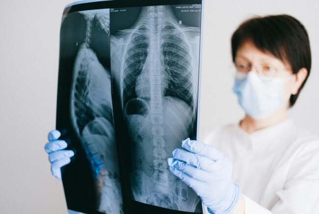 Spitalul Victor Babeș Timișoara a realizat peste 3.800 de investigații imagistice în 2024