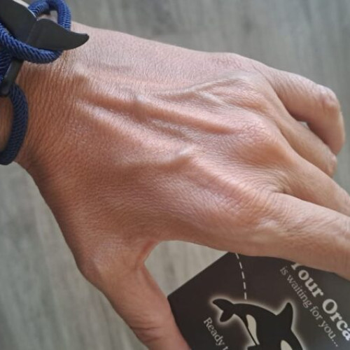 Profesoara Monica Mocanu poartă o brățară cu balena Rangi pentru a susține protejarea animalelor marine