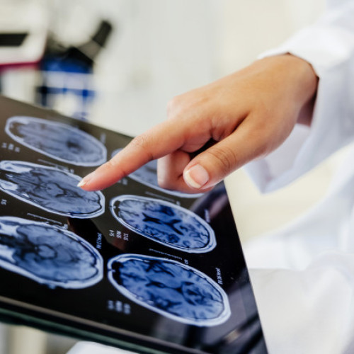 Primul pacient operat pe creier în timp ce era treaz la Spitalul Bagdasar Arseni