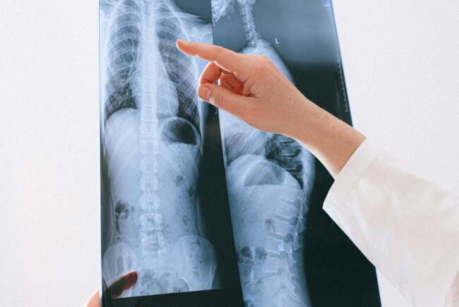 România se confruntă cu o rată ridicată a cazurilor de boală pulmonară obstructivă cronică