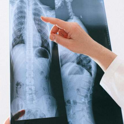 România se confruntă cu o rată ridicată a cazurilor de boală pulmonară obstructivă cronică