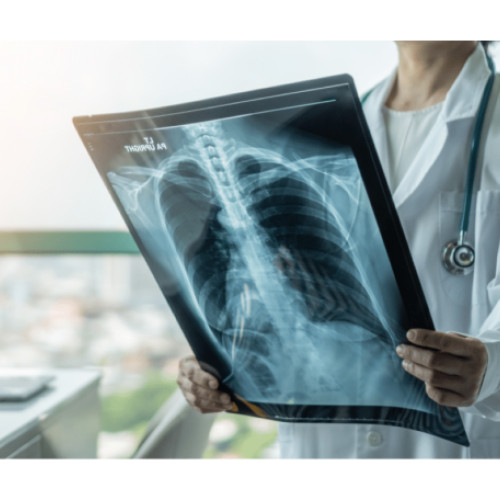 Numărul infecțiilor respiratorii în județul Bihor se menține în limite normale