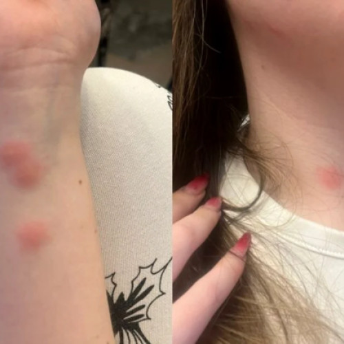 Tineri mușcați de ploșnițe în trenurile CFR, prețurile continuă să crească