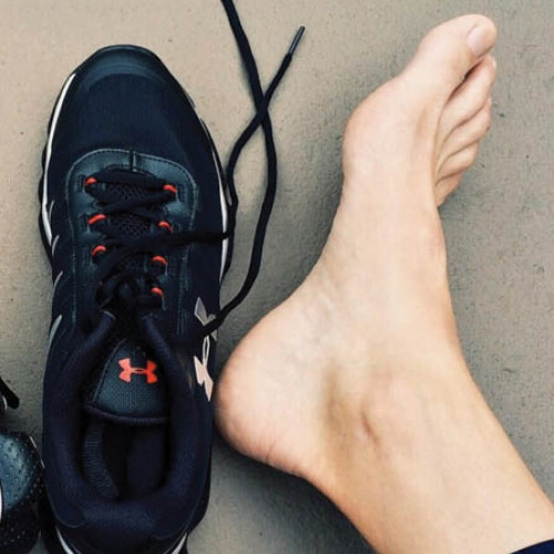 Purtarea încălţămintei strâmte favorizează apariţia unghiilor încarnate şi a altor afecţiuni