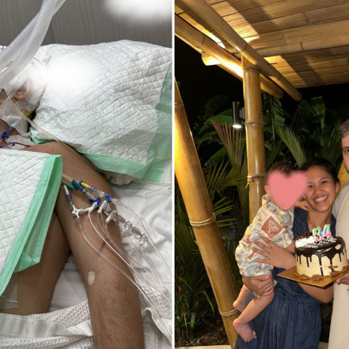 Tânăr român grav rănit într-un accident de motocicletă în Bali