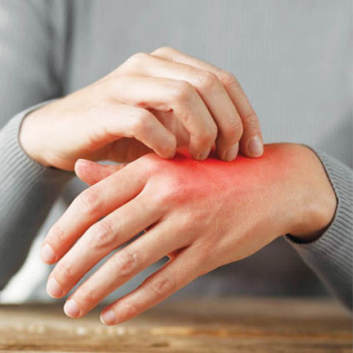 Numărul bolilor dermatologice a crescut, dar au apărut și tratamente noi