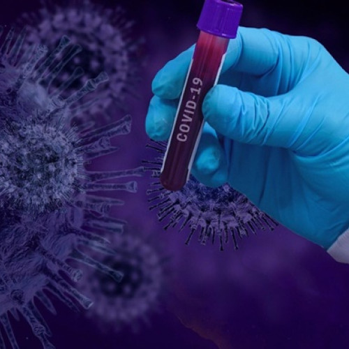 29 de cazuri noi de reinfectare COVID-19 în ultima săptămână, fără decese raportate