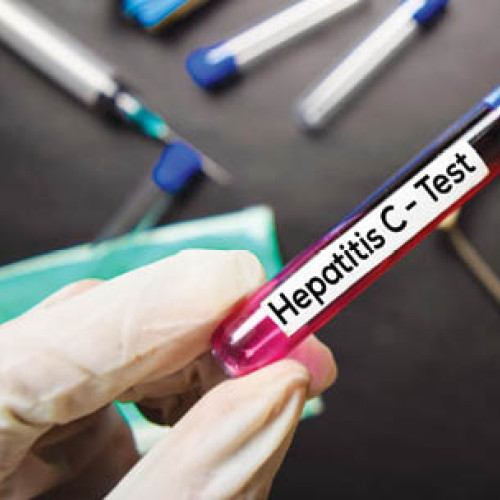 Testare gratuită pentru hepatita B, C și HIV disponibilă pentru toți cei cu simptome