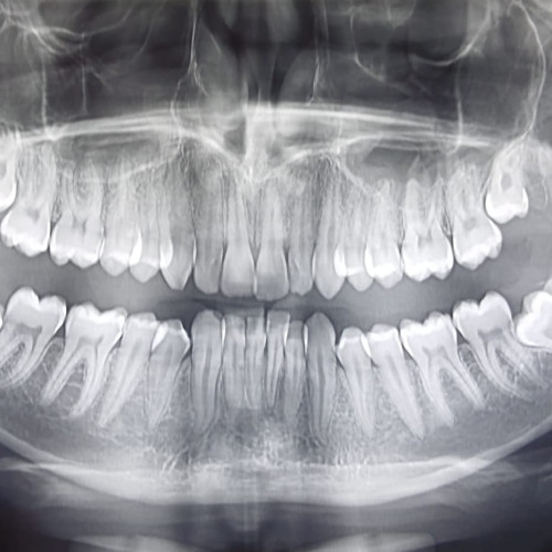 CAS Tulcea oferă servicii stomatologice decontate pentru un zâmbet sănătos